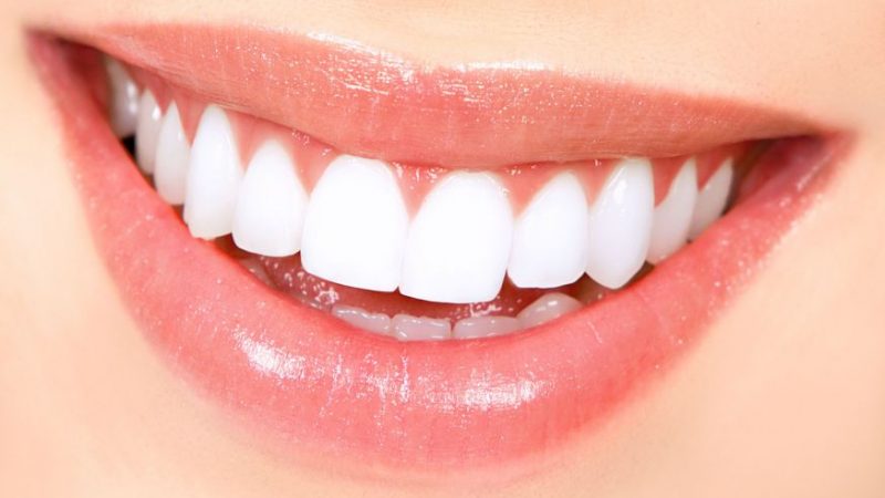 Cum să-ți menții dinții albi după procesul de albire dentară