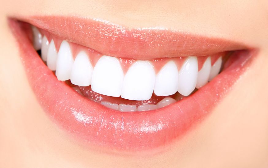 Cum să-ți menții dinții albi după procesul de albire dentară